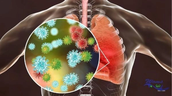 Is Pneumonia Contagious after antibiotics