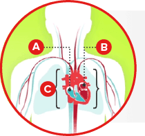 Heart failure guidelines for treatment