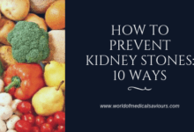 How to prevent kidney stones: 10 ways-woms