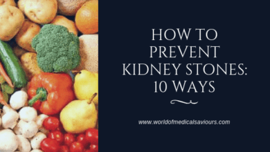 How to prevent kidney stones: 10 ways-woms