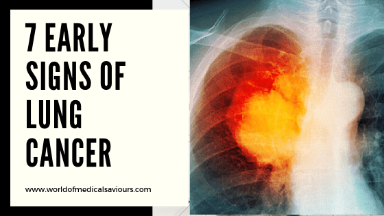 7 early signs of lung cancer-woms
