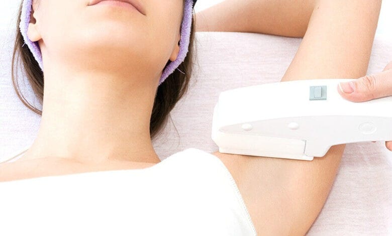 laser therapy for hair removal