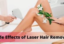 Side Effects of Laser Hair Removal