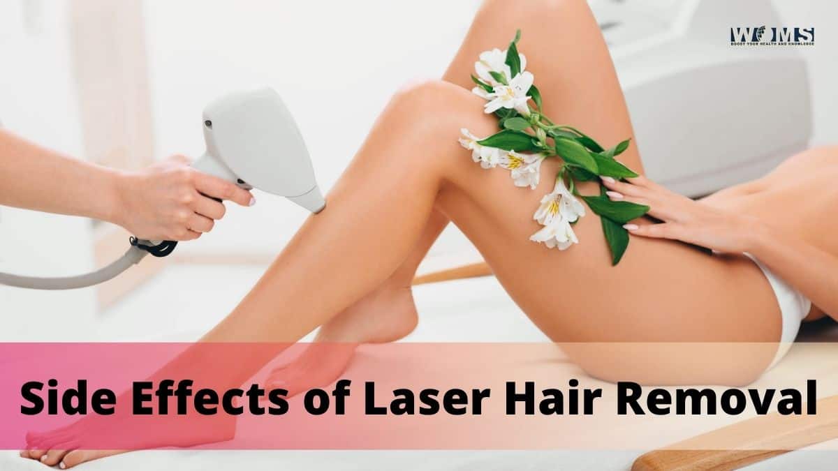 Laser Hair Removal  Side Effects Benefits Cost  More  Bodycraft