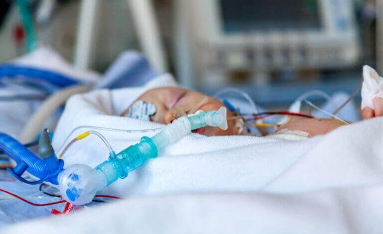 Perinatal asphyxia (PNA)
