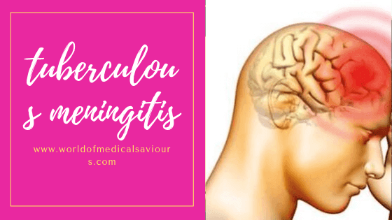 Tuberculous meningitis