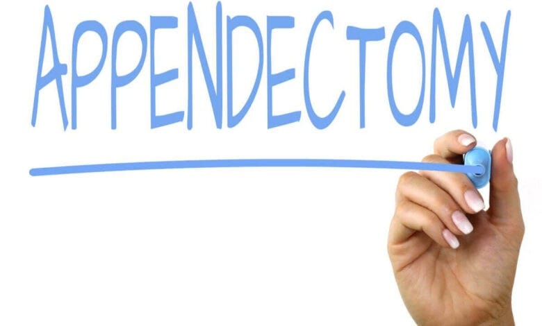Appendectomy