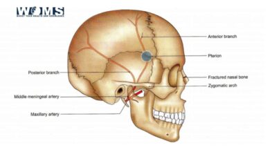 Middle meningeal artery