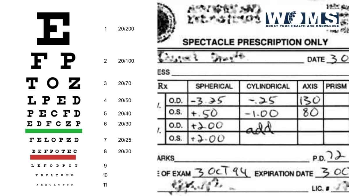 2,75 prescrição ocular é ruim?