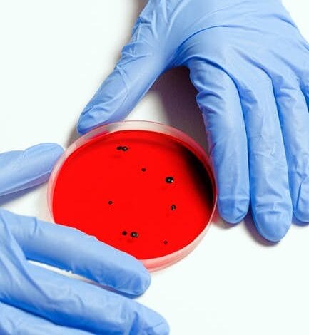 SFTS virus