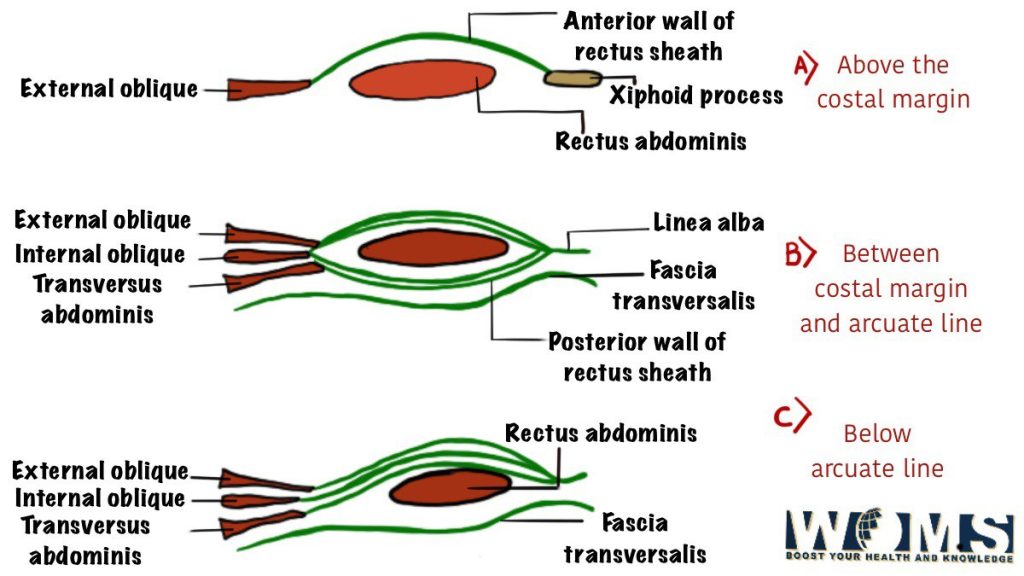 transverse sections through the rectus abdominis and it's sheath in anterior abdominal wall