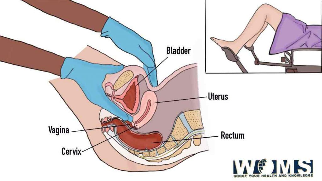 vaginal examination