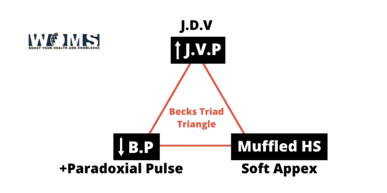 Becks Triad The Medical Triad Woms