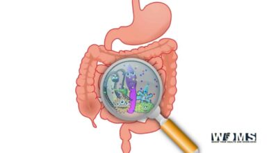 What is SIBO | small intestinal bacterial overgrowth