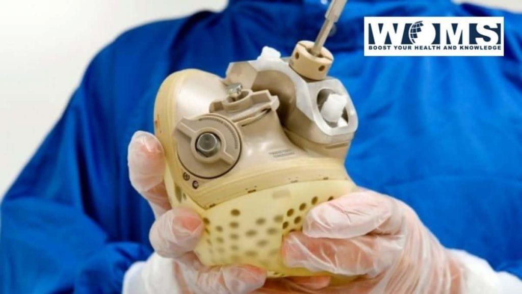 First Total Artificial Heart Implant Carried Out With a Feminine WOMS