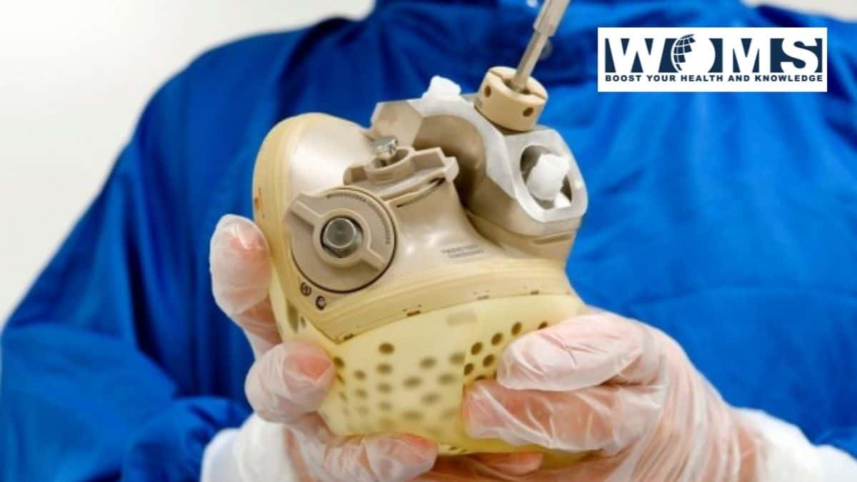 Total Artificial Heart Implant