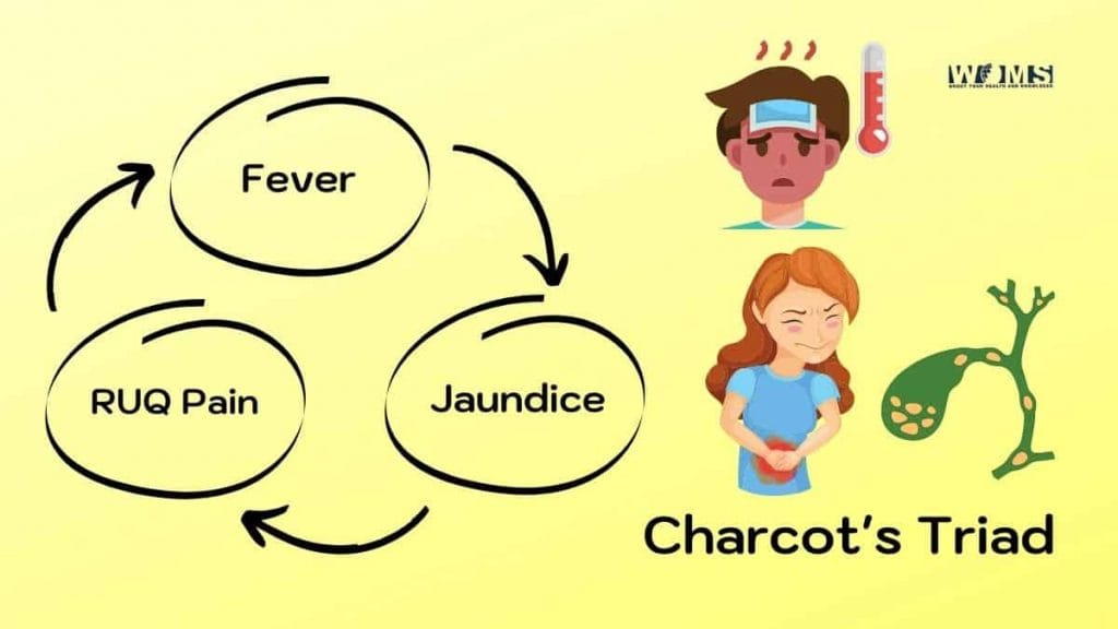 Charcot's Triad - WOMS