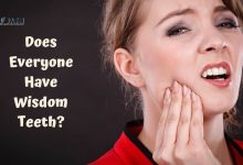 Does Everyone Have Wisdom Teeth