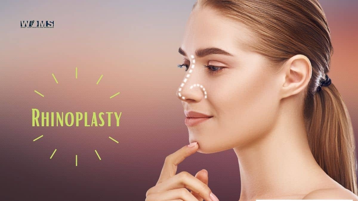 rhinoplasty