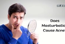 Does Masturbation Cause Acne