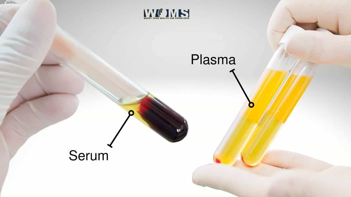 Serum vs Plasma