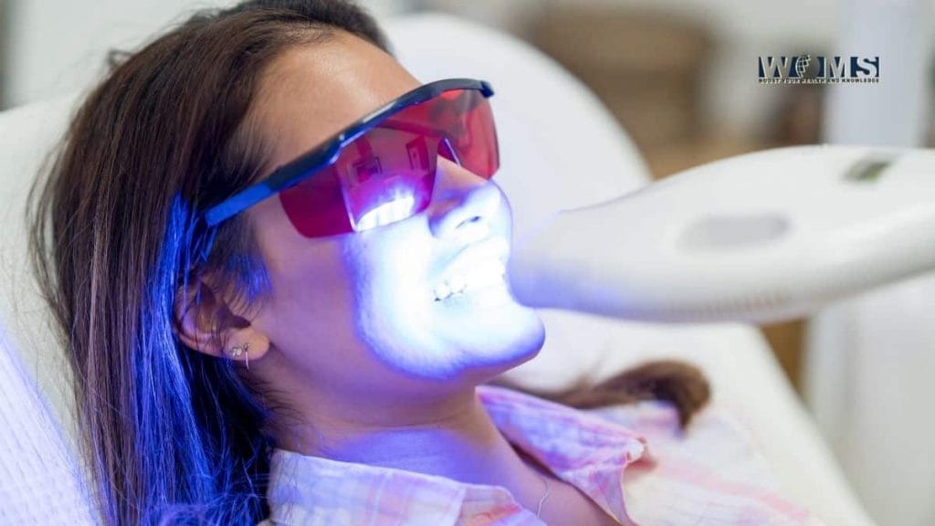 Advantages of Laser Teeth Whitening WOMS