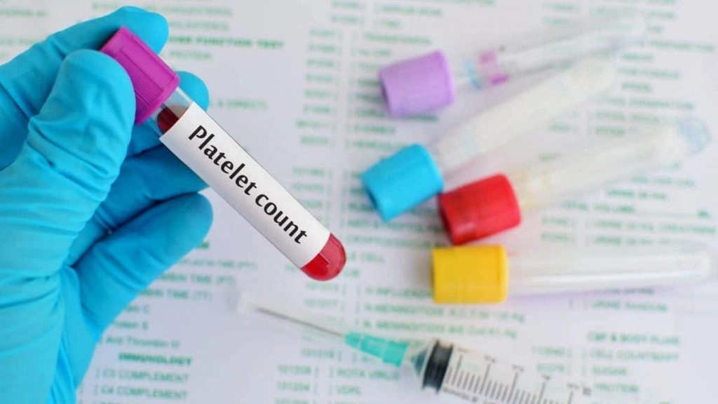 what-is-normal-platelet-count-and-how-does-it-work-woms