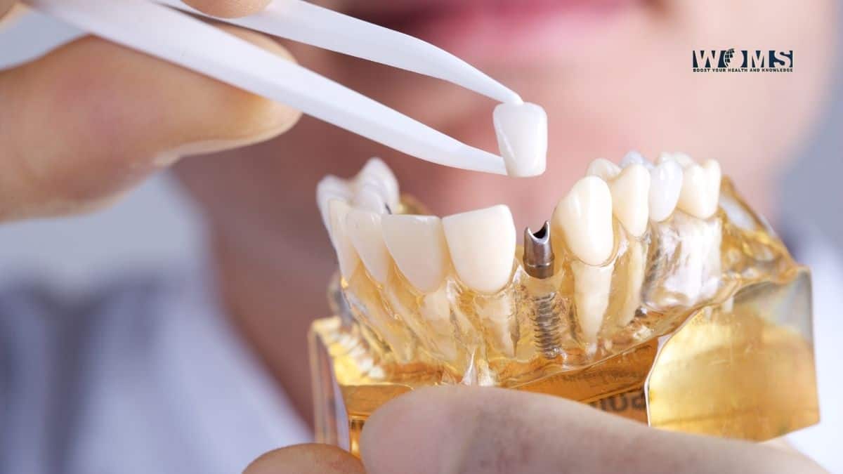 Dental Implants Clinic Near Me