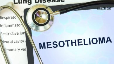 Mesothelioma treatment
