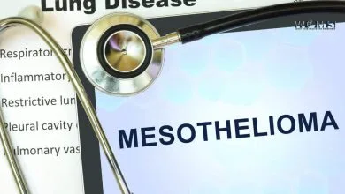 Mesothelioma treatment