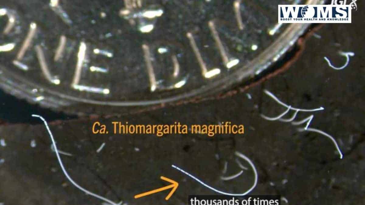 Largest Bacteria Thiomargarita Magnifica