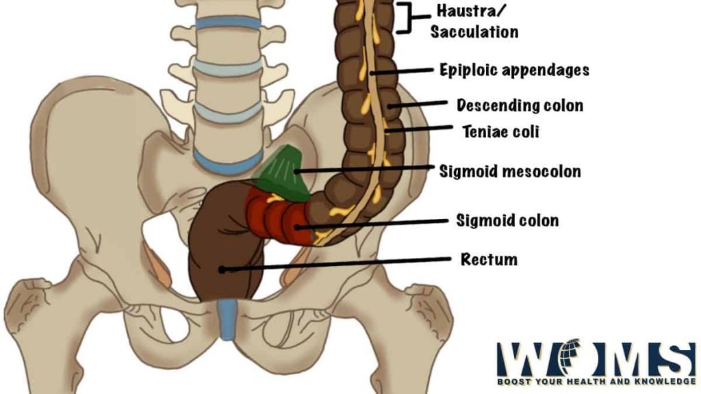 Sigmoid Colon 7 Important Clinical Conditions Woms 4204