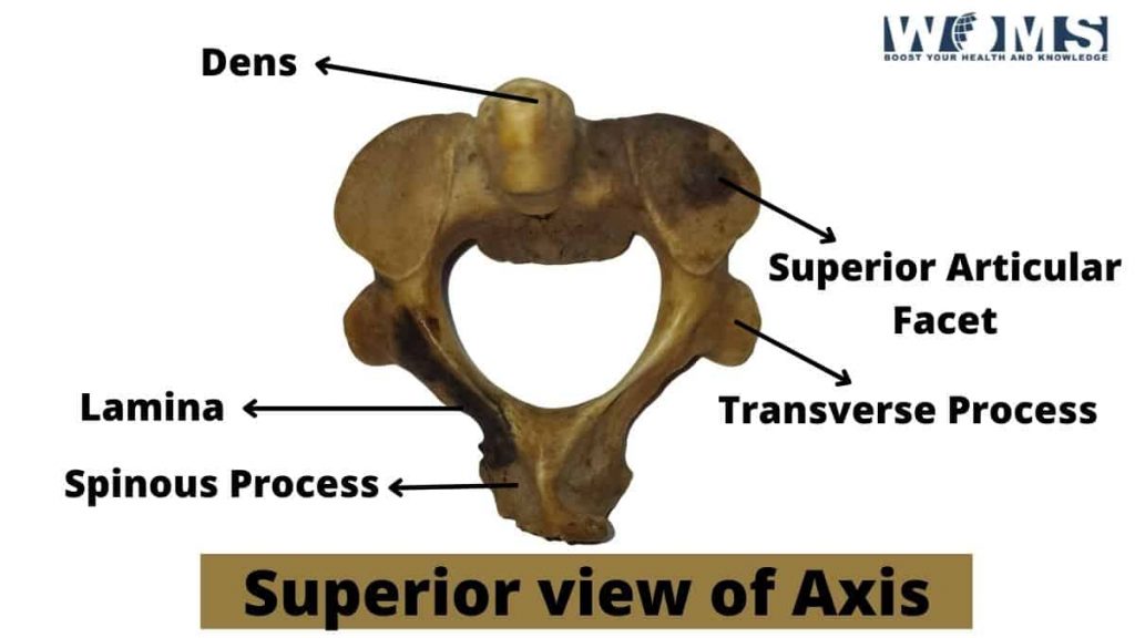 axis cervical vertebrae