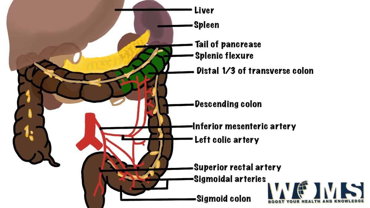 Sigmoid Colon 7 Important Clinical Conditions WOMS
