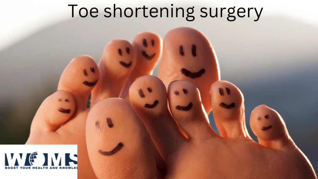 Toe Shortening Surgery Procedure, Complications and Recovery WOMS