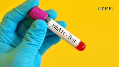 What Is HbA1C