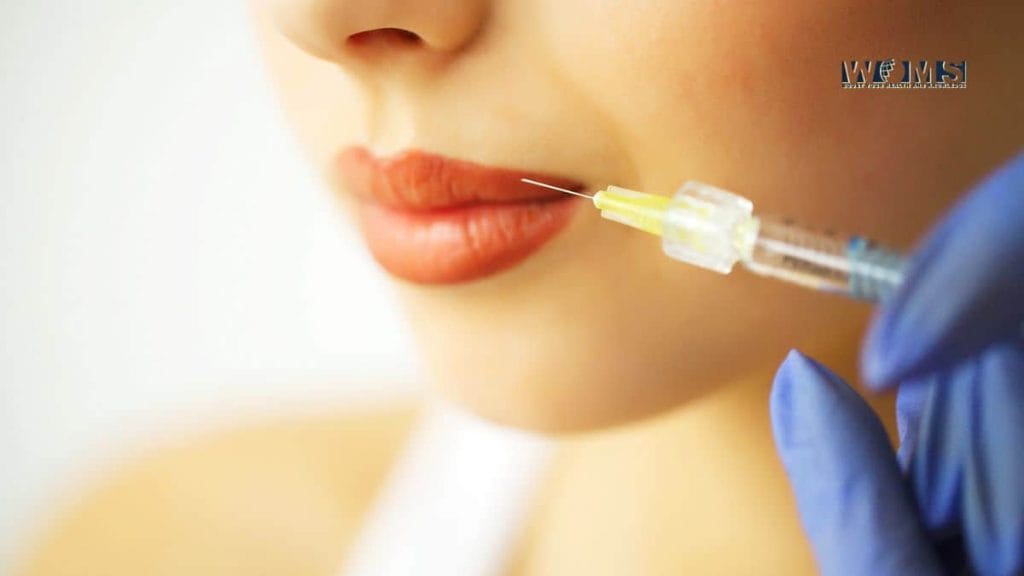 Do lip fillers change your lips until the end of time? WOMS