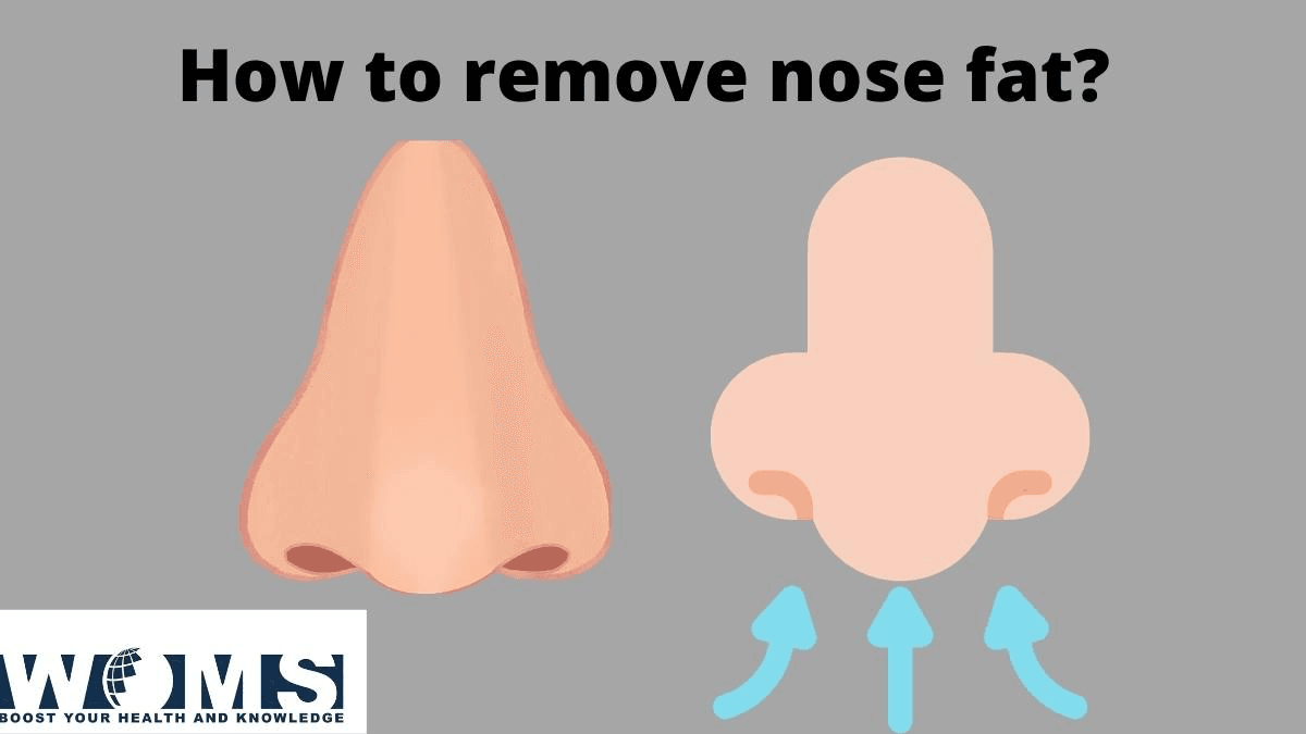 Nose FAt