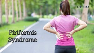 How To Sleep With Piriformis Syndrome Woms