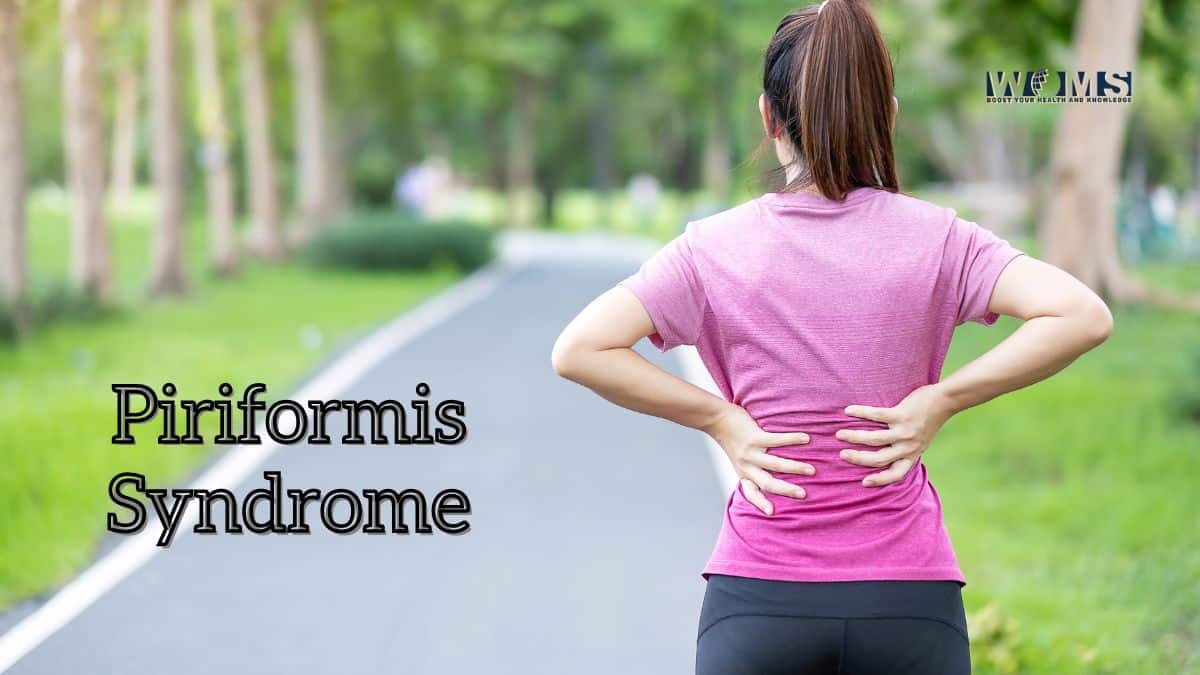 How to Sleep with Piriformis Syndrome? - WOMS