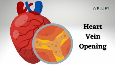 Heart Vein Opening