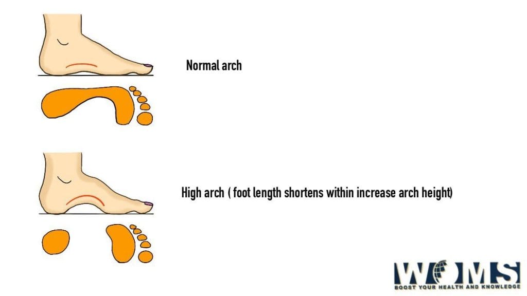 how-to-make-your-feet-smaller-8-effective-tips-woms