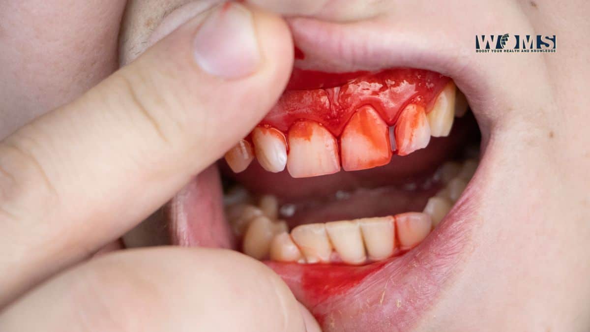 Dental Conditions That are Emergencies