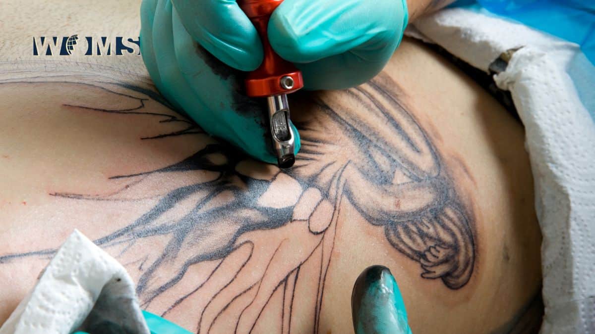 Are There Any Harmful Effects of Laser Tattoo Removal Treatment