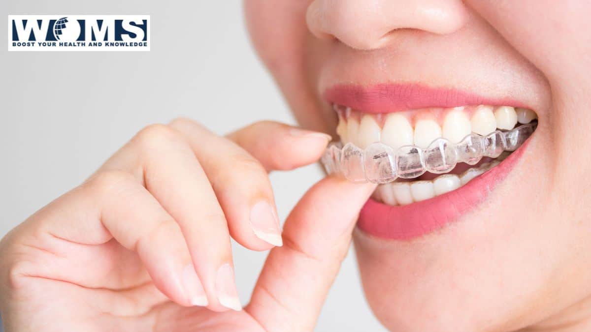 how does invisalign work