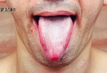 Tongue Muscles