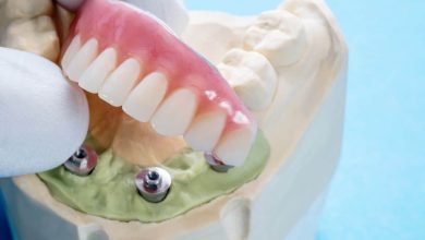 Dental Implants Over Dentures