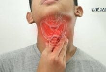 Throat Cancer Symptoms